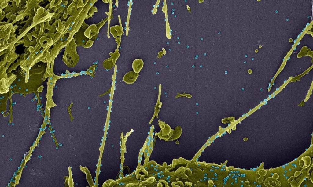 pesquisadores-identificam-no-rio-possivel-nova-linhagem-do-coronavirus