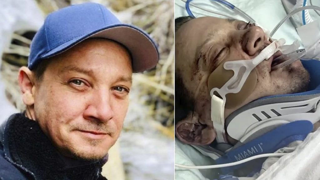 O ator Jeremy renner sofreu um grave acidente em janeiro e a recuperação surpreende